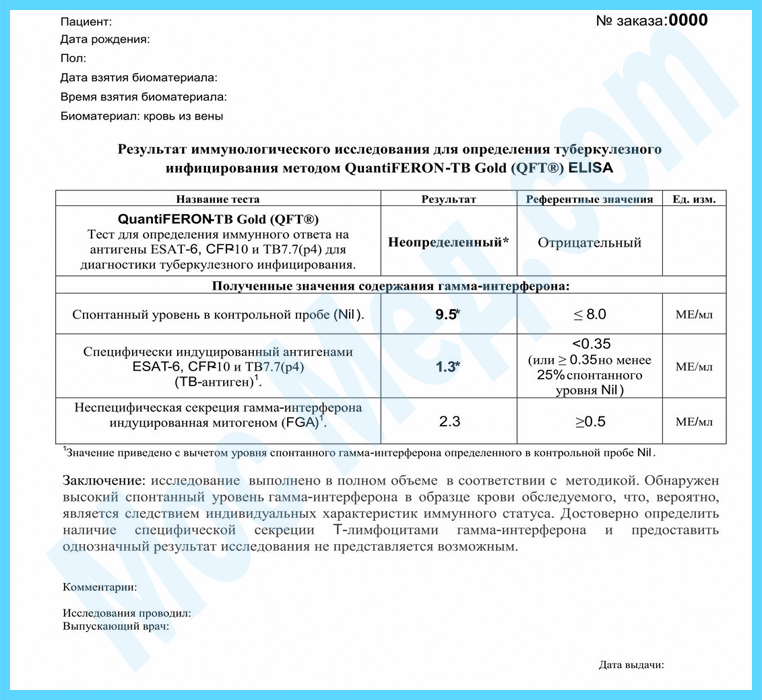 Подлинный результат теста на антитела к гепатиту C с печатями